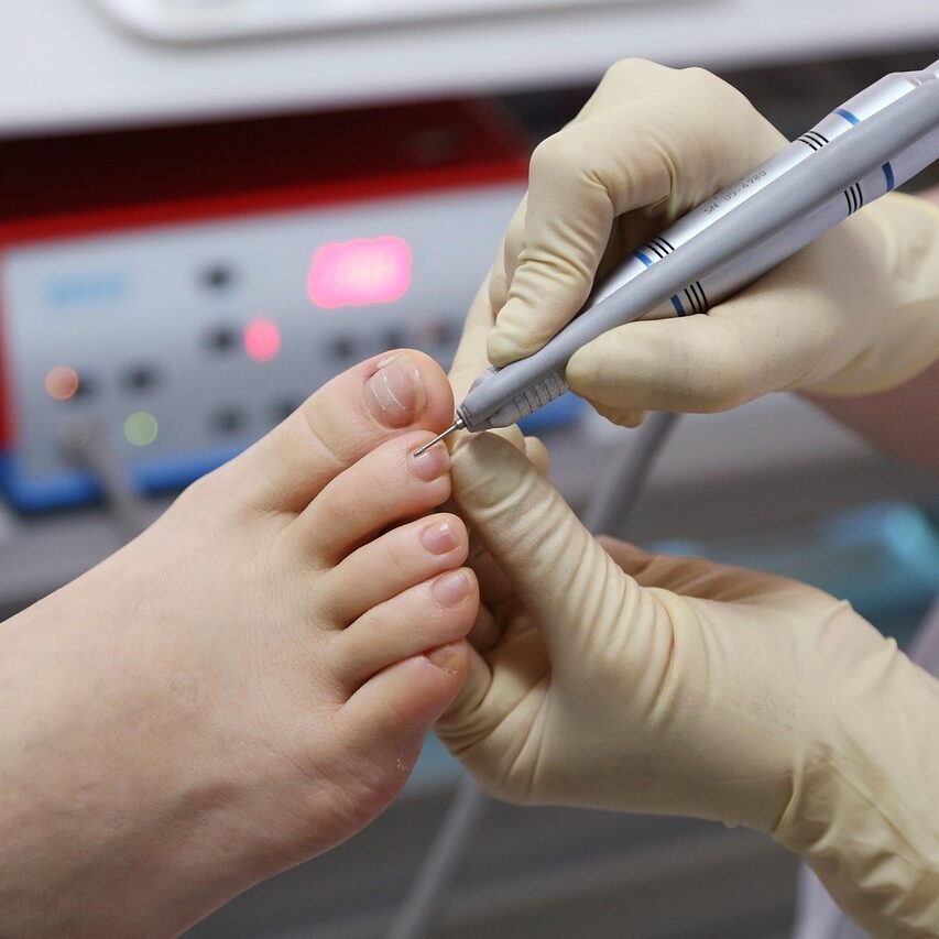 toenails, foot care, foot, nail care, toes, hygiene, hand tool, podiatrist, closeup, foot care, foot care, podiatrist, podiatrist, podiatrist, podiatrist, podiatrist